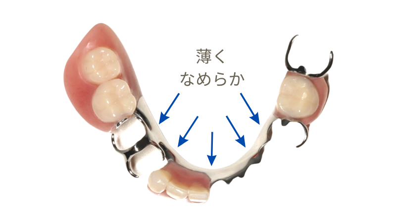 しゃべりやすい入れ歯